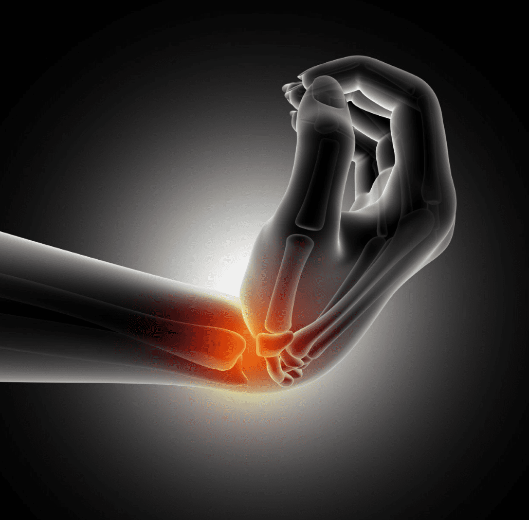 cintilografia óssea exame