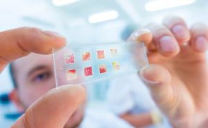 o que é biopsia para que serve doi riscos