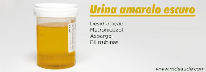 Cor da urina escura, amarela ou com espuma o que pode ser?