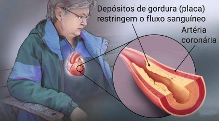 Evitando doenças com o check-up cardiológico