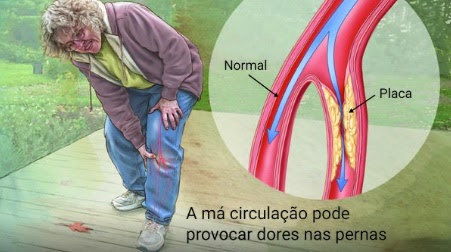 prevenção de doenças cardíacas
