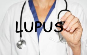 O que é Lúpus e quais são os sintomas