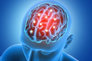 Sintomas do tumor na cabeça