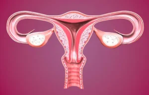 Endometriose profunda: sintomas, diagnóstico e tratamentos